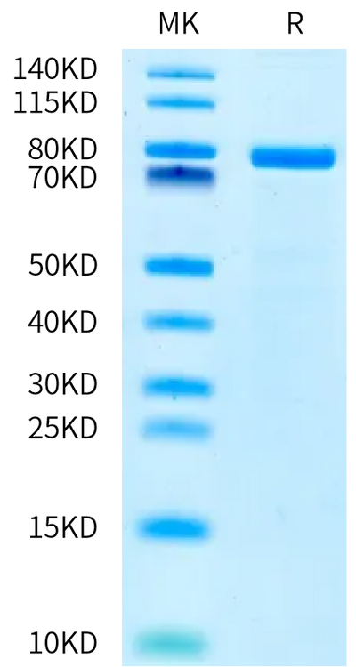 Human DLL3 on Bis-Tris PAGE under reduced condition. The purity is greater than 90%.Recombinant Human DLL3 Protein, Active