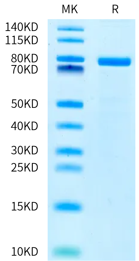 Human DLL3 on Bis-Tris PAGE under reduced condition. The purity is greater than 90%.Recombinant Human DLL3 Protein, Active