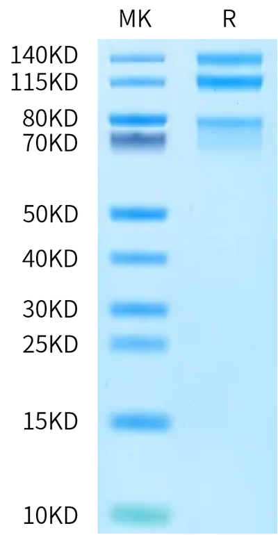 Cynomolgus ITGA4&ITGB7 on Bis-Tris PAGE under reduced condition. The purity is greater than 95%.Recombinant Cynomolgus Integrin alpha 4 beta 7 (ITGA4&ITGB7) Heterodimer Protein, Active