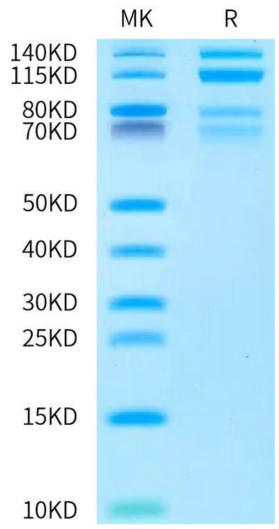 Biotinylated Human ITGA4&ITGB7 on Bis-Tris PAGE under reduced condition. The purity is greater than 95%.Biotinylated Human Integrin alpha 4 beta 7 (ITGA4&ITGB7) Heterodimer Protein, Active