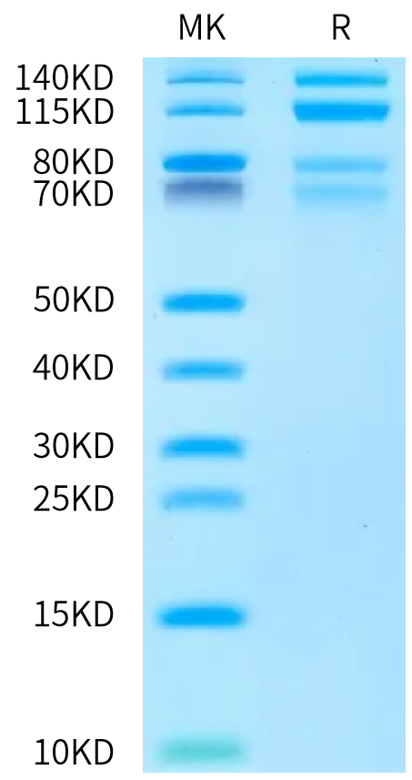 Biotinylated Human ITGA4&ITGB7 on Bis-Tris PAGE under reduced condition. The purity is greater than 95%.Biotinylated Human Integrin alpha 4 beta 7 (ITGA4&ITGB7) Heterodimer Protein, Active
