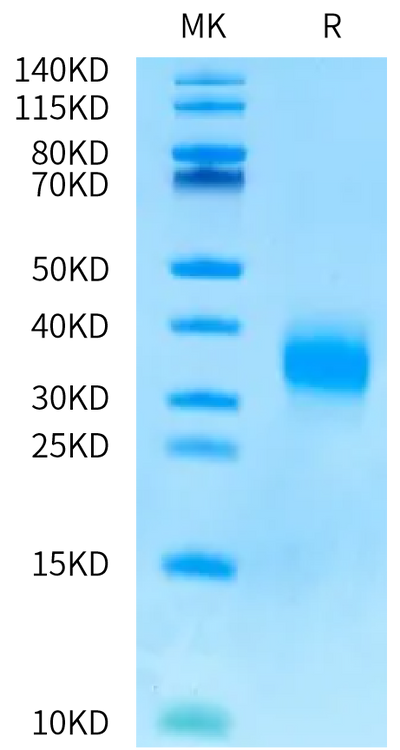Human SOST on Bis-Tris PAGE under reduced condition. The purity is greater than 95%.Recombinant Human SOST/Sclerostin Protein, Active
