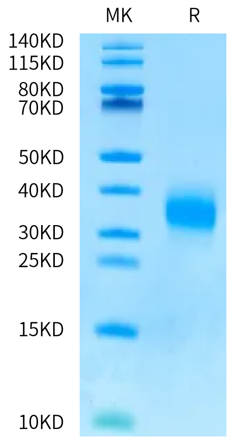 Human SOST on Bis-Tris PAGE under reduced condition. The purity is greater than 95%.Recombinant Human SOST/Sclerostin Protein, Active