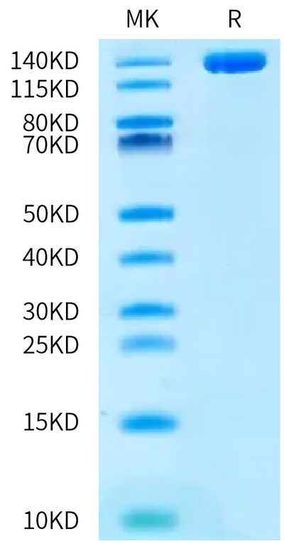 Human ENPP-3 on Bis-Tris PAGE under reduced condition. The purity is greater than 95%.Recombinant Human ENPP-3 Protein, Active