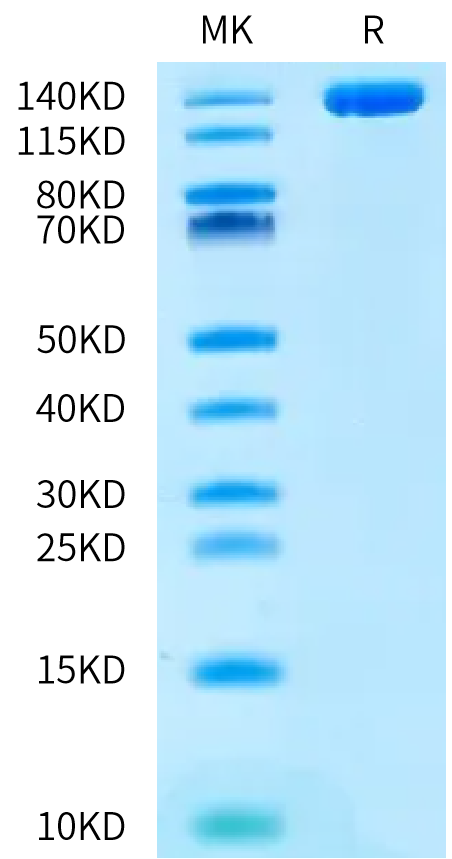 Human ENPP-3 on Bis-Tris PAGE under reduced condition. The purity is greater than 95%.Recombinant Human ENPP-3 Protein, Active