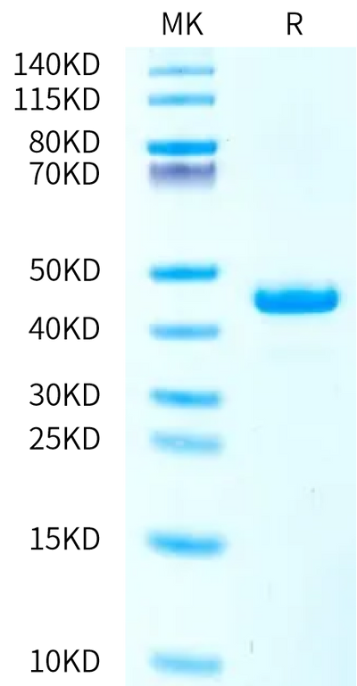 Human ITPRIPL1 on Bis-Tris PAGE under reduced condition. The purity is greater than 95%.Recombinant Human ITPRIPL1/CD3L1 Protein