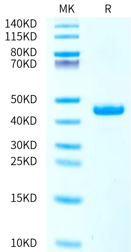 Human ITPRIPL1 on Bis-Tris PAGE under reduced condition. The purity is greater than 95%.Recombinant Human ITPRIPL1/CD3L1 Protein