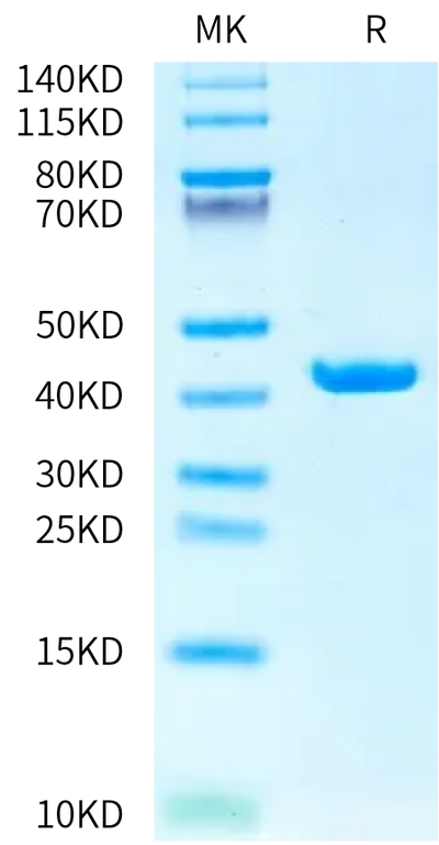 Human SEZ6 Sushi4 Domain on Bis-Tris PAGE under reduced condition. The purity is greater than 95%.Recombinant Human SEZ6 Sushi4 Domain Protein