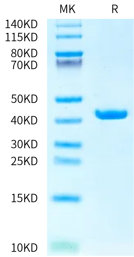 Human SEZ6 Sushi4 Domain on Bis-Tris PAGE under reduced condition. The purity is greater than 95%.Recombinant Human SEZ6 Sushi4 Domain Protein