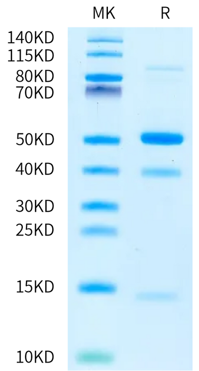 Cynomolgus Latent GDF-8 on Bis-Tris PAGE under reduced condition. The purity is greater than 95%.Recombinant Cynomolgus Latent GDF-8 Protein, Active