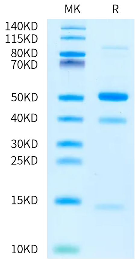 Cynomolgus Latent GDF-8 on Bis-Tris PAGE under reduced condition. The purity is greater than 95%.Recombinant Cynomolgus Latent GDF-8 Protein, Active