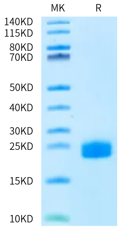 Biotinylated Human DLL3 Domain (352-479) on Bis-Tris PAGE under reduced condition. The purity is greater than 95%.Biotinylated Human DLL3 Domain (352-479) Protein