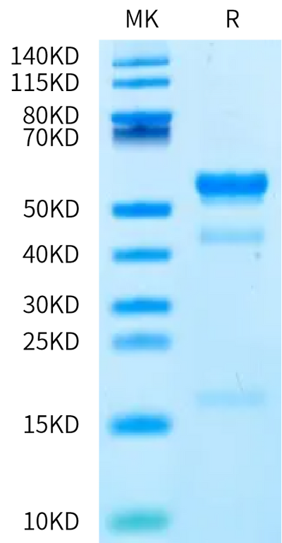 Human Latent GDF-11 on Bis-Tris PAGE under reduced condition. The purity is greater than 95%.Recombinant Human Latent GDF-11 Protein, Active