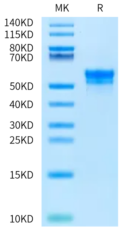 Rat TIGIT on Bis-Tris PAGE under reduced condition. The purity is greater than 95%.Recombinant Rat TIGIT Protein, Active