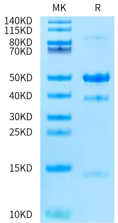Mouse Latent GDF-8 on Bis-Tris PAGE under reduced condition. The purity is greater than 95%.Recombinant Mouse Latent GDF-8 Protein, Active