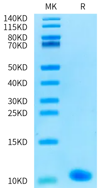 Human IGFI on Bis-Tris PAGE under reduced condition. The purity is greater than 95%.Recombinant Human IGFI Protein, Active