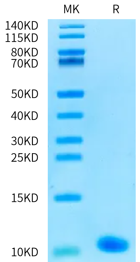 Human IGFI on Bis-Tris PAGE under reduced condition. The purity is greater than 95%.Recombinant Human IGFI Protein, Active
