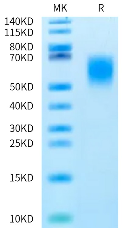 Rat B7-H2 on Bis-Tris PAGE under reduced condition. The purity is greater than 95%.Recombinant Rat B7-H2/ICOSLG Protein, Active