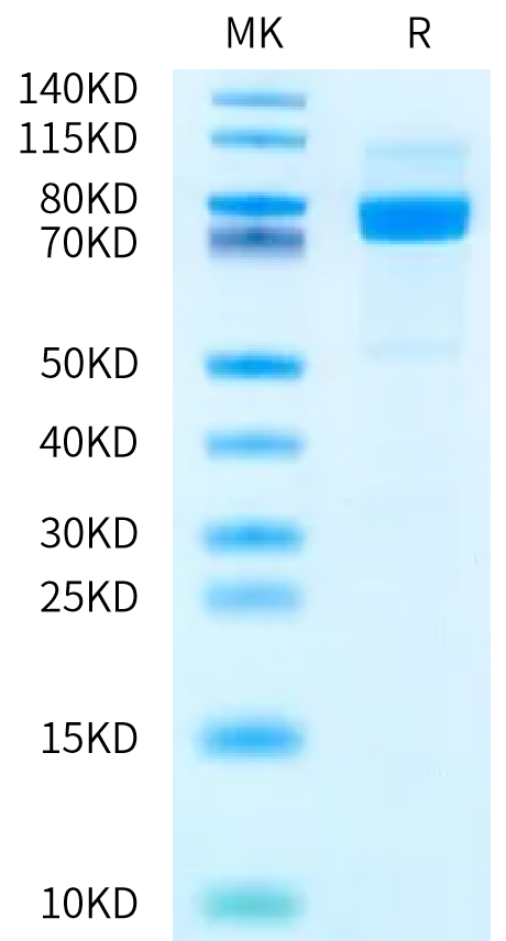 Human CDH9 on Bis-Tris PAGE under reduced condition. The purity is greater than 90%.Recombinant Human CDH9/Cadherin 9 Protein