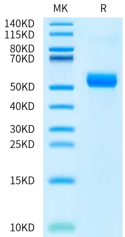 Biotinylated Human ANGPTL7 on Bis-Tris PAGE under reduced condition. The purity is greater than 95%.Biotinylated Human ANGPTL7/CDT6 Protein, Active