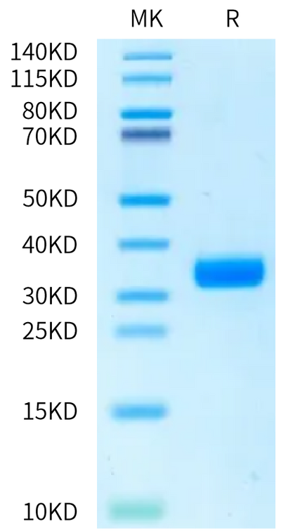 Rat ANGPT2 on Bis-Tris PAGE under reduced condition. The purity is greater than 95%.Recombinant Rat ANGPT2/Angiopoietin-2 Protein