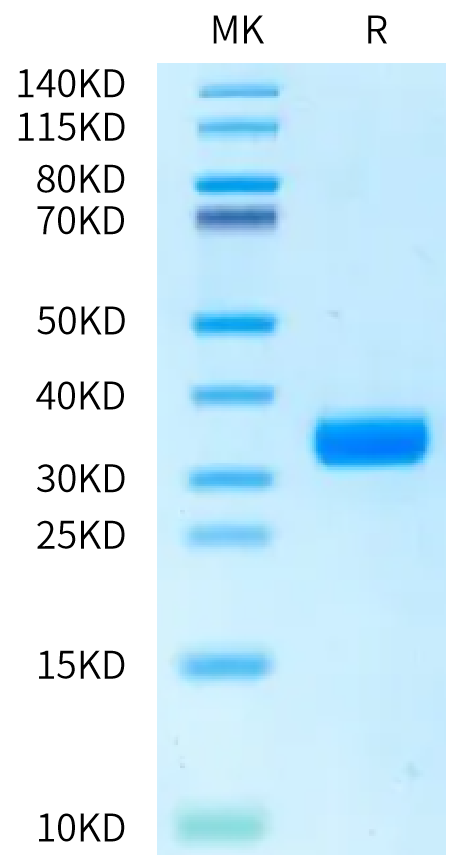 Rat ANGPT2 on Bis-Tris PAGE under reduced condition. The purity is greater than 95%.Recombinant Rat ANGPT2/Angiopoietin-2 Protein