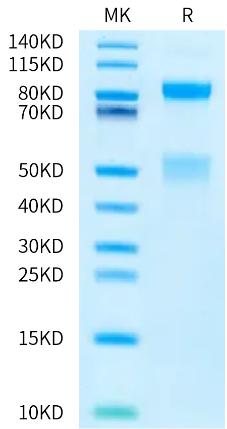 Human HGF R on Bis-Tris PAGE under reduced condition. The purity is greater than 95%.Recombinant Human HGF R/c-MET Protein, Active