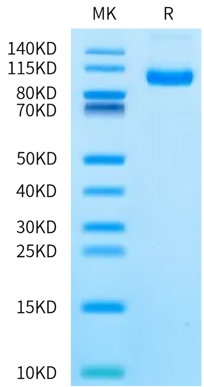 Human CDCP1 (30-440) on Bis-Tris PAGE under reduced condition. The purity is greater than 95%.Recombinant Human CDCP1 (30-440) Protein, Active