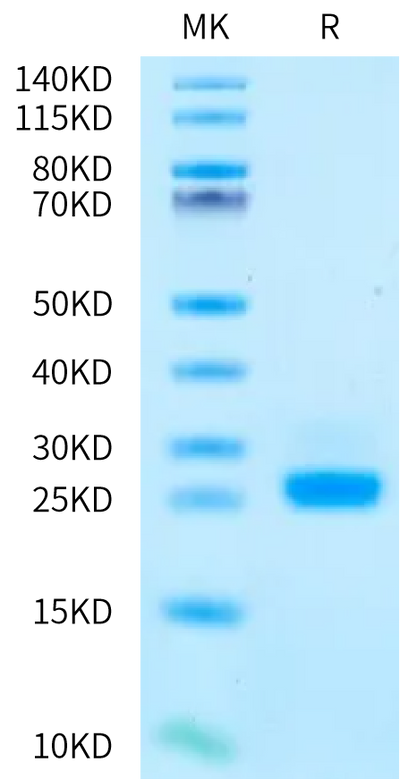 Human IL-6 on Bis-Tris PAGE under reduced condition. The purity is greater than 95%.Recombinant Human IL-6 Protein, Active