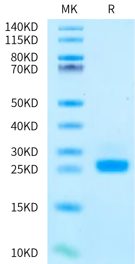 Human IL-6 on Bis-Tris PAGE under reduced condition. The purity is greater than 95%.Recombinant Human IL-6 Protein, Active