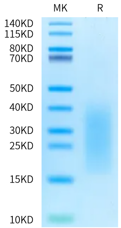 Rat ALK-7 on Bis-Tris PAGE under reduced condition. The purity is greater than 95%.Recombinant Rat ALK-7/Activin RIC Protein, Active