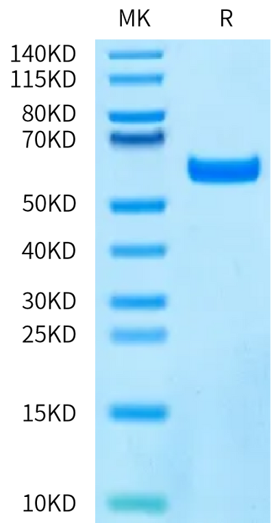 Human VEGF165 on Bis-Tris PAGE under reduced condition. The purity is greater than 95%.Recombinant Human VEGF165 Protein, Active