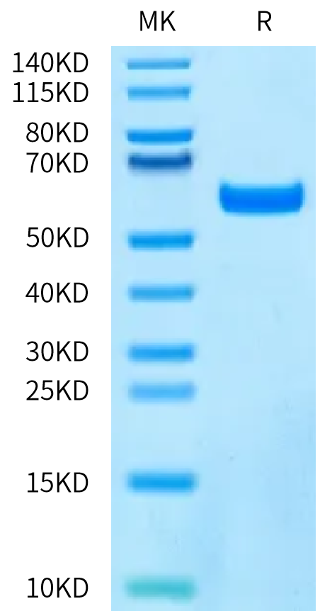 Human VEGF165 on Bis-Tris PAGE under reduced condition. The purity is greater than 95%.Recombinant Human VEGF165 Protein, Active