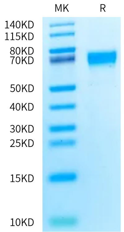 Rat AXL on Bis-Tris PAGE under reduced condition. The purity is greater than 95%.Recombinant Rat AXL Protein