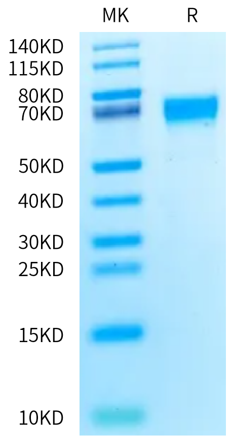 Rat AXL on Bis-Tris PAGE under reduced condition. The purity is greater than 95%.Recombinant Rat AXL Protein