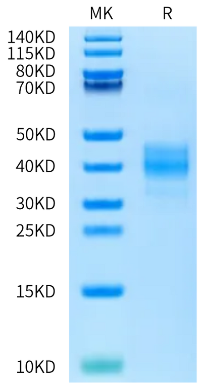 Rat ASGR1 on Bis-Tris PAGE under reduced condition. The purity is greater than 95%.Recombinant Rat ASGR1 Protein