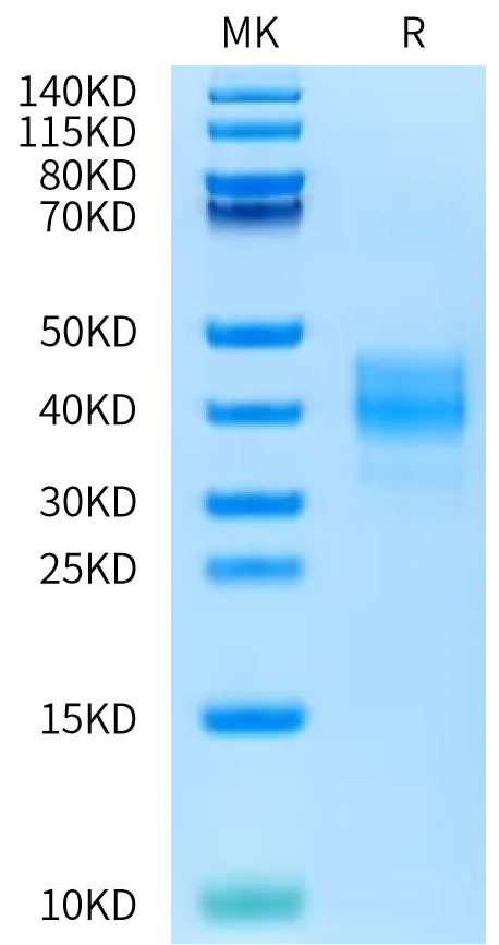 Rat ASGR1 on Bis-Tris PAGE under reduced condition. The purity is greater than 95%.Recombinant Rat ASGR1 Protein