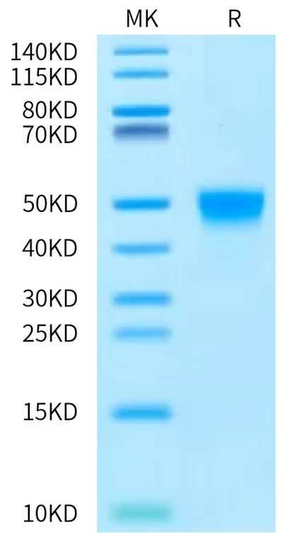 Rat Fc gamma RI on Bis-Tris PAGE under reduced condition. The purity is greater than 95%.Recombinant Rat Fc gamma RI/CD64 Protein, Active