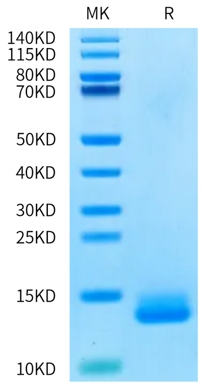 Human ITPRIPL1 on Bis-Tris PAGE under reduced condition. The purity is greater than 95%.Recombinant Human ITPRIPL1/CD3L1 Protein