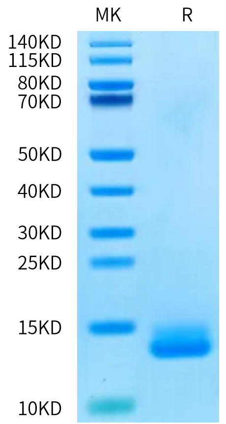Human ITPRIPL1 on Bis-Tris PAGE under reduced condition. The purity is greater than 95%.Recombinant Human ITPRIPL1/CD3L1 Protein