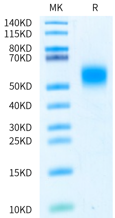 Biotinylated Human IL-7 R alpha on Bis-Tris PAGE under reduced condition. The purity is greater than 95%.Biotinylated Human IL-7 R alpha/CD127 Protein, Active
