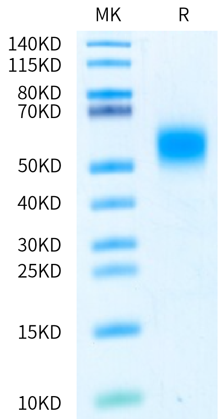 Biotinylated Human IL-7 R alpha on Bis-Tris PAGE under reduced condition. The purity is greater than 95%.Biotinylated Human IL-7 R alpha/CD127 Protein, Active