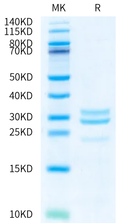Human Kallikrein 7 on Bis-Tris PAGE under reduced condition. The purity is greater than 95%.Recombinant Human Kallikrein 7/KLK7 Protein, Active