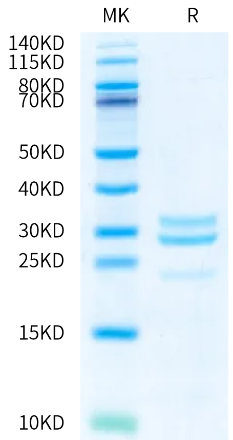 Human Kallikrein 7 on Bis-Tris PAGE under reduced condition. The purity is greater than 95%.Recombinant Human Kallikrein 7/KLK7 Protein, Active