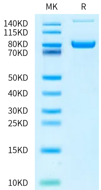 Human Transferrin R on Bis-Tris PAGE under reduced condition. The purity is greater than 90%.Recombinant Human Transferrin R/CD71 Protein, Active