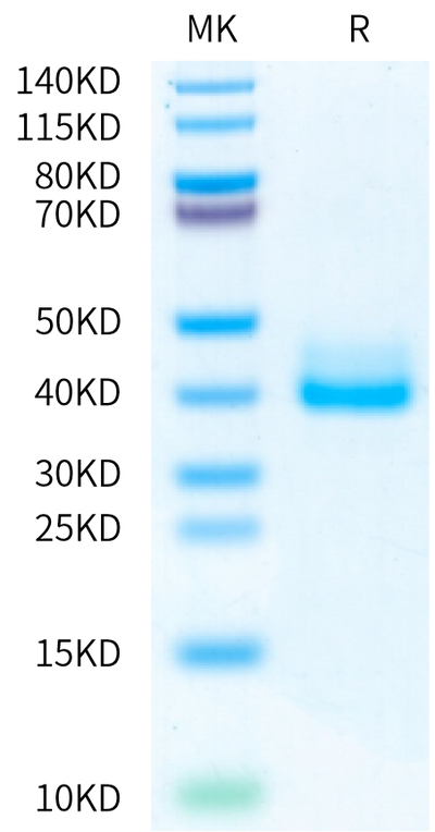 Biotinylated Mouse IgE on Bis-Tris PAGE under reduced condition. The purity is greater than 95%.Biotinylated Mouse IgE Protein, Active