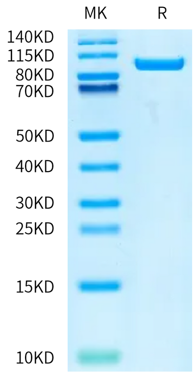 Human Serum Albumin on Bis-Tris PAGE under reduced condition. The purity is greater than 95%.Recombinant Human Serum Albumin Protein