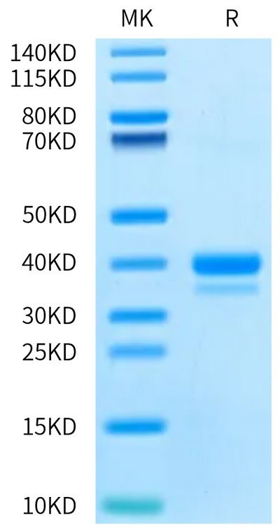 Biotinylated Cynomolgus IgE on Bis-Tris PAGE under reduced condition. The purity is greater than 95%.Biotinylated Cynomolgus IgE Protein, Active