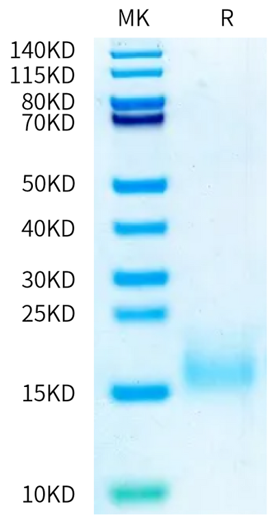 Human BCMA (P33S) on Bis-Tris PAGE under reduced condition. The purity is greater than 95%.Recombinant Human BCMA/TNFRSF17 (P33S) Protein, Active