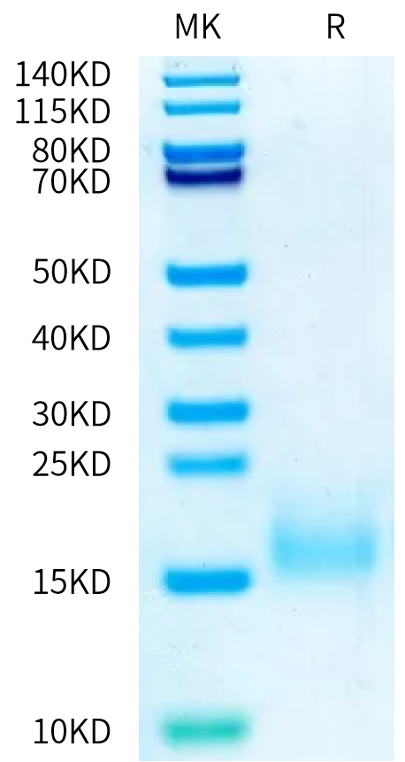 Human BCMA (P33S) on Bis-Tris PAGE under reduced condition. The purity is greater than 95%.Recombinant Human BCMA/TNFRSF17 (P33S) Protein, Active